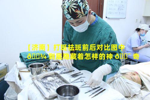 【济南】打斑祛斑前后对比图中 🌾 到底隐藏着怎样的神 🐯 奇变化